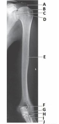 What anatomy is labeled as letter B in the image below?   A)  Greater tubercle B)  Lesser tubercle C)  Humeral head D)  Glenoid