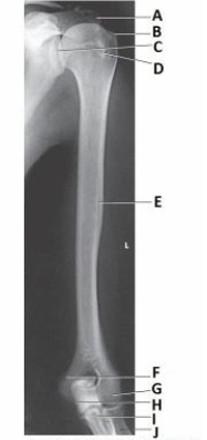What projection and anatomy is demonstrated in the image below?   A)  AP forearm B)  AP humerus C)  Lateral forearm D)  Lateral humerus