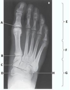 The group of bones labeled as G in the image below are the:   A)  phalanges. B)  metatarsals. C)  digits. D)  tarsals.