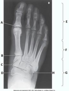 Letter H in the image below labels the:   A)  navicular. B)  cuboid. C)  talus. D)  lateral cuneiform.