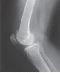  Where does the central ray enter the patient in the image below?   A)   1 / 2  inch below the patellar apex B)  1 inch below the patellar apex C)   1 / 2  inch proximal to the medial epicondyle D)  1 inch distal to the medial epicondyle 