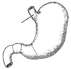 The area identified in the figure below is the:   A)  fundus. B)  angular notch. C)  cardiac antrum. D)  lesser curvature.