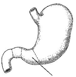 The part of the stomach identified in the figure below is the:   A)  greater curvature. B)  pyloric antrum. C)  pyloric canal. D)  pyloric sphincter.