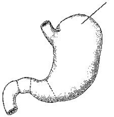 The area identified in the figure below is the:   A)  fundus. B)  body. C)  cardiac antrum. D)  greater curvature.