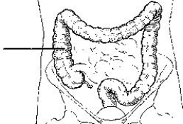 The area of the colon identified in the figure below is the:   A)  left colic flexure. B)  right colic flexure. C)  ascending colon. D)  descending colon.