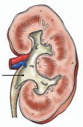 <strong>The area of the kidney identified in the figure below is the: </strong> A) hilum. B) renal pelvis. C) renal sinus. D) minor calyx.