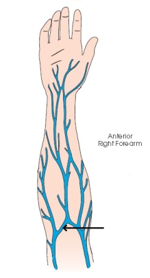 What vein, often used for venipuncture, is labeled with the arrow in the diagram below?   A)  Basilic vein B)  Cephalic vein C)  Radial vein D)  Median cubital vein
