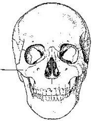 The bone indicated in the figure below is the:   A)  parietal. B)  orbital. C)  temporal. D)  zygoma.