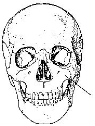 The bone identified in the figure below is the:   A)  maxilla. B)  frontal. C)  mandible. D)  ethmoid.