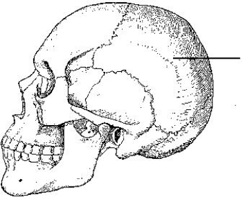 The bone indicated in the figure below is the:   A)  temporal. B)  parietal. C)  occipital. D)  sphenoid.