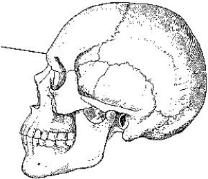 The part of the frontal bone indicated in the figure below is the:   A)  bregma. B)  lambda. C)  glabella. D)  acanthion.