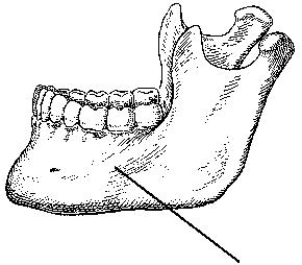 The part of the mandible identified in the figure below is the:   A)  body. B)  ramus. C)  symphysis. D)  alveolar portion.