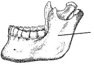 The portion of the mandible identified in the figure below is the:   A)  body. B)  ramus. C)  symphysis. D)  alveolar portion.