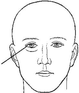 The external landmark identified in the figure below is the:   A)  glabella. B)  acanthion. C)  outer canthus. D)  infraorbital margin.