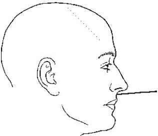 The landmark identified in the figure below is the:   A)  nasion. B)  glabella. C)  acanthion. D)  auricular point.