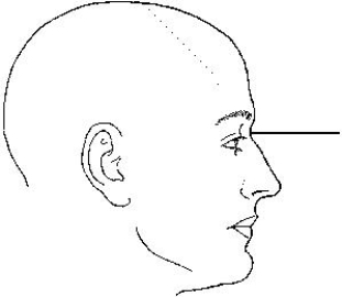 The landmark identified in the figure below is termed the:   A)  nasion. B)  glabella. C)  acanthion. D)  inner canthus.