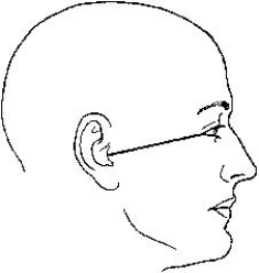 The topographic line shown in the figure below is the _____ line.   A)  glabellomeatal B)  orbitomeatal C)  acanthiomeatal D)  infraorbitomeatal