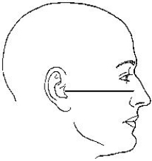 The topographic line identified in the figure below is the _____ line.   A)  orbitomeatal B)  mentomeatal C)  acanthiomeatal D)  infraorbitomeatal