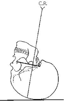 The x-ray projection demonstrated in the figure below is the:   A)  SMV. B)  VSM. C)  AP axial. D)  PA axial.