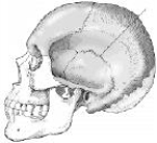 The suture identified on the figure below is the:   A)  coronal. B)  squamosal. C)  sagittal. D)  lambdoidal.