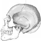 The bone identified on the skull below is the:   A)  temporal. B)  parietal. C)  occipital. D)  sphenoid.