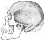 The bone identified on the skull below is the:   A)  temporal. B)  parietal. C)  zygoma. D)  sphenoid.