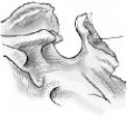 The part of the sphenoid bone identified in the figure below is the:   A)  clivus. B)  clinoid processes. C)  sella turcica. D)  dorsum sellae.