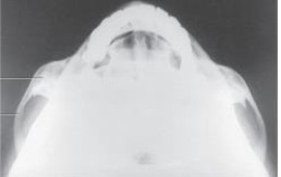 What projection and anatomy is demonstrated in the image below?   A)  SMV of the TMJs B)  SMV of the zygomatic arches C)  AP axial of the TMJs D)  AP axial of the zygomatic arches