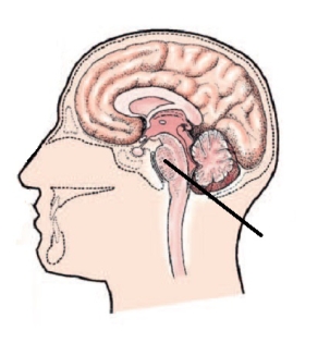 What part of the brain is indicated by the line in the diagram?   A)  Pons B)  Cerebrum C)  Cerebellum D)  Brainstem