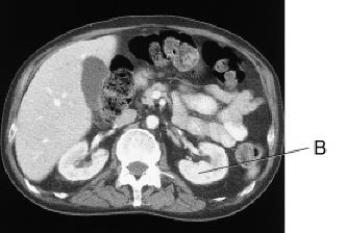 Line B on this image is pointing to the:   A)  liver. B)  spleen. C)  L kidney. D)  gallbladder.