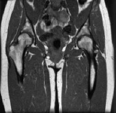 The plane on this image is a(n) :   A)  coronal. B)  axial. C)  sagittal. D)  midsagittal.