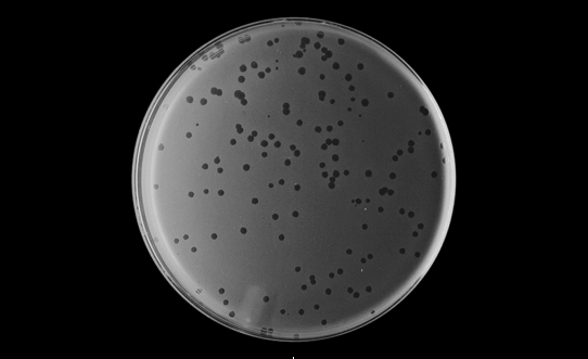 When mixed with their host bacterium and plated on solid agar, lytic phage will form clear areas in the bacterial growth. What are these clear areas called?   A)  plaques B)  zones of inhibition C)  assays D)  titers E)  halos