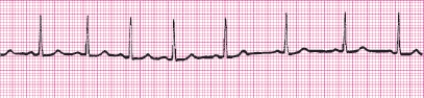 Identify the following rhythm (lead II): ____________________   