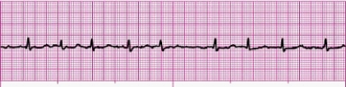 Identify the following rhythm (lead II): ____________________   