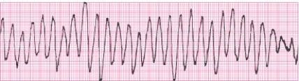 Identify the following rhythm (lead II): ____________________   