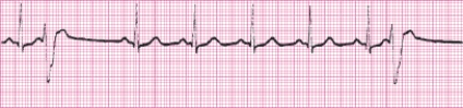 Identify the following rhythm (lead II): ____________________   