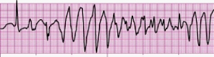 Identify the following rhythm (lead II): ____________________   