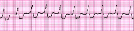 Identify the following rhythm (lead II): ____________________   
