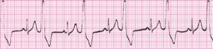 Identify the following rhythm (lead II): ____________________   