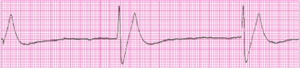 Identify the following rhythm (lead II): ____________________   
