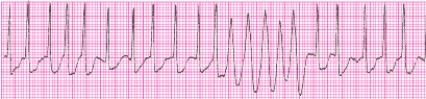 Identify the following rhythm (lead II): ____________________   