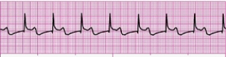 Identify the following rhythm (lead II): ____________________   