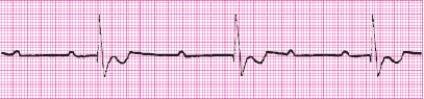 Identify the following rhythm: _________________________   