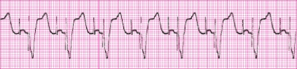 Identify the following rhythm: _________________________   