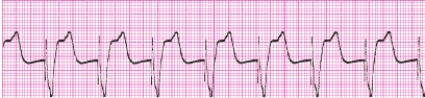 Identify the following rhythm: _________________________   
