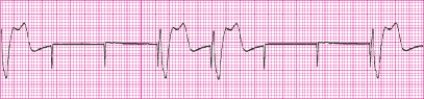 Identify the following rhythm: _________________________   