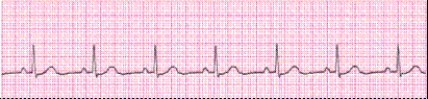 Completion -Identify the following rhythm (lead II): ____________________   