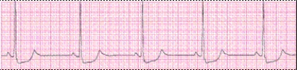 Completion -Identify the following rhythm (lead II): ____________________   