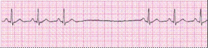 Completion -Identify the following rhythm (lead II): ____________________   
