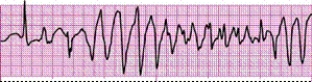 Identify the following rhythm (lead II): ____________________   